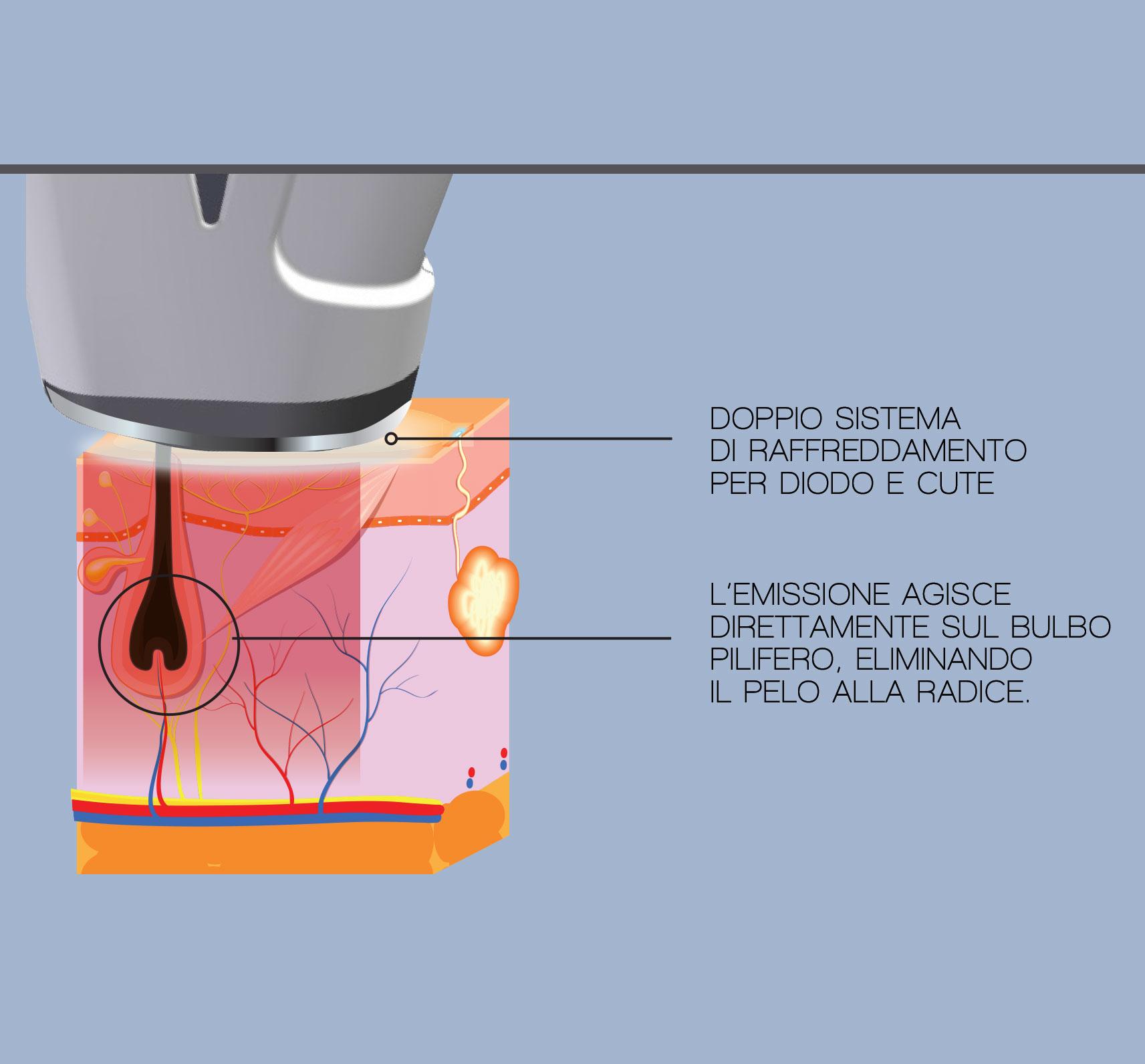 epilatori laser professionale